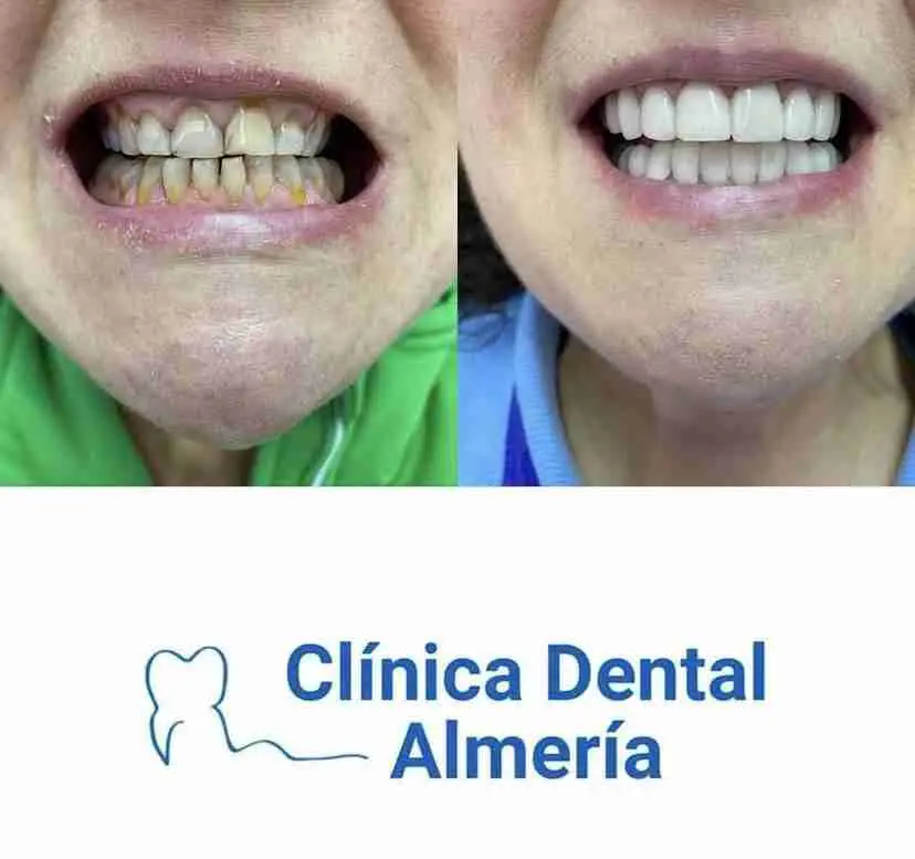 Fotos de Clinica dental Almeria, Calle Hermanos Pinzón, Barrio de las Cruces, Regiones Devastadas, Almeria, Andalucía, 04005, España