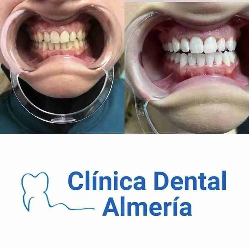 Fotos de Clinica dental Almeria, Calle Hermanos Pinzón, Barrio de las Cruces, Regiones Devastadas, Almeria, Andalucía, 04005, España
