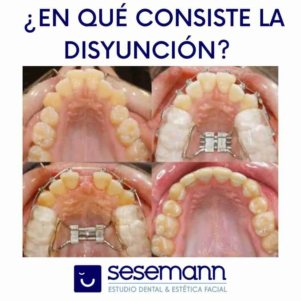 Fotos de SESEMANN DENTAL CAMPOS DEL RIO, Avenida de La Constitución, Campos del Río, Río Mula, Región de Murcia, 30190, España