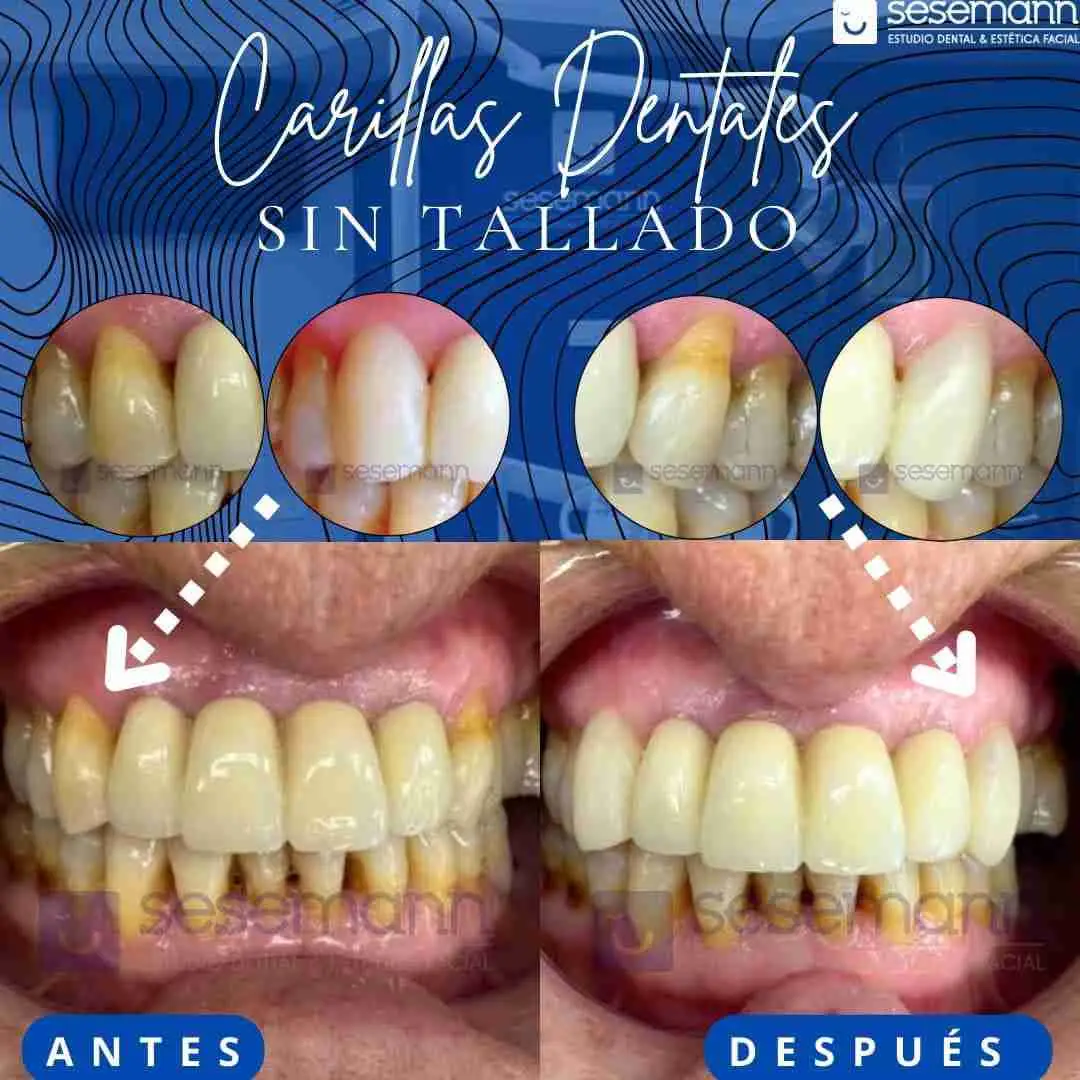 Fotos de SESEMANN DENTAL CAMPOS DEL RIO, Avenida de La Constitución, Campos del Río, Río Mula, Región de Murcia, 30190, España