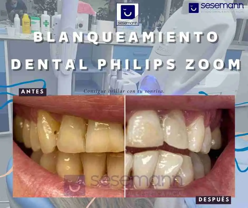 Fotos de SESEMANN DENTAL CAMPOS DEL RIO, Avenida de La Constitución, Campos del Río, Río Mula, Región de Murcia, 30190, España
